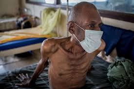 Becoming very ill with Tuberculosis