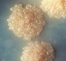 Colonies of Mycobacterium tuberculosis growth on a culture plate as part of a TB culture test © CDC/Dr George Kubica