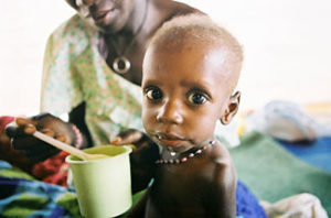 TB makes malnutrition worse