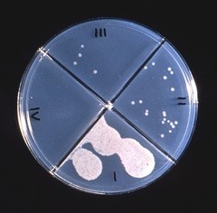 Agar culture plates reveal the results of a drug susceptibility test. © CDC